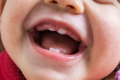 Caring for Baby Teeth- Why It’s Important