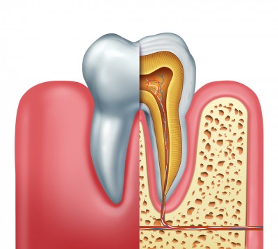 Removing the Stigma from Root Canal Therapy