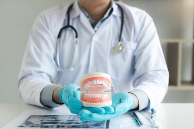 False Teeth or Dentures: What You Should Know