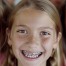Orthodontics and Braces for Kids, Warren, MI